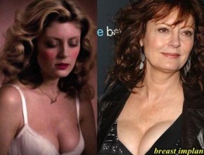 Susan Sarandon breast implants plastic surgery (17)