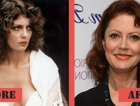 Susan Sarandon plastic surgery (22)