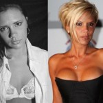 Victoria Beckham before and after breast augmentation (18)