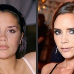 Victoria Beckham before and after facelift (8)