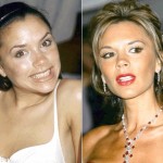Victoria Beckham before and after plastic surgery (17)