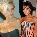 Victoria Beckham plastic surgery changes