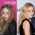 Ashley and Mary Kate Olsen before and after plastic surgery