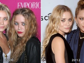 Ashley and Mary Kate Olsen before and after plastic surgery