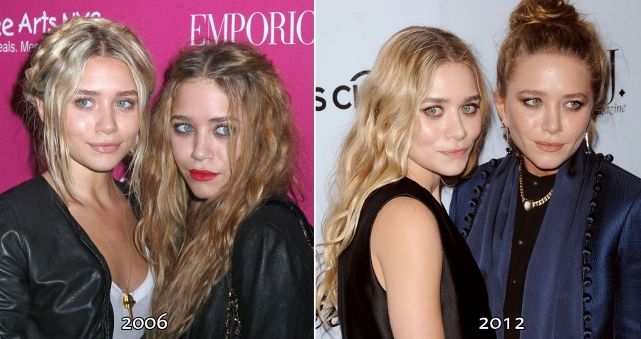 Ashley and Mary Kate Olsen before and after plastic surgery