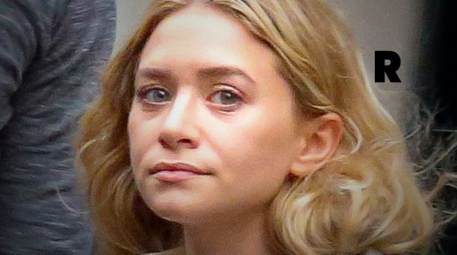 Ashley Olsen after plastic surgery