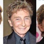 Barry Manilow before and after plastic surgery