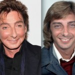 Barry Manilow before and after plastic surgery