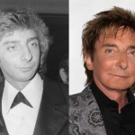 Barry Manilow before and after plastic surgery