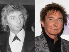 Barry Manilow before and after plastic surgery