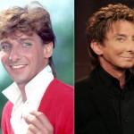 Barry Manilow before and after plastic surgery