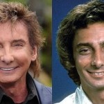 Barry Manilow before and after plastic surgery