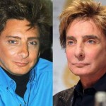 Barry Manilow before and after plastic surgery (5)