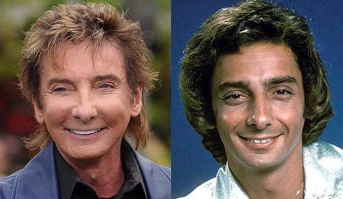 Barry Manilow before and after plastic surgery