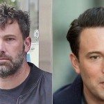 Ben Affleck before and after plastic surgery