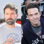 Ben Affleck before and after plastic surgery (25)