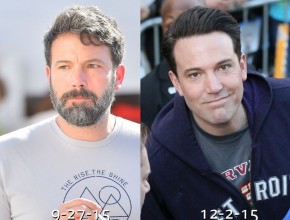 Ben Affleck before and after plastic surgery (25)