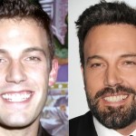 Ben Affleck before and after plastic surgery (35)