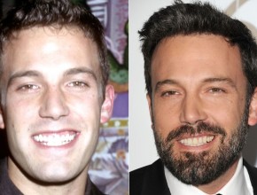 Ben Affleck before and after plastic surgery (35)