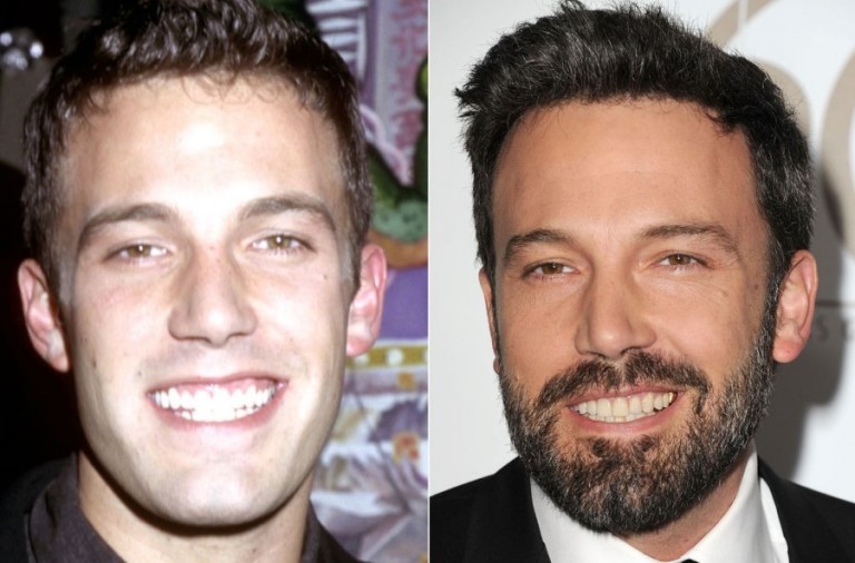 Ben Affleck improving his look with plastic surgery?