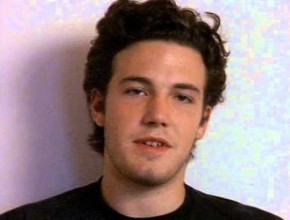 Ben Affleck before plastic surgery (30)