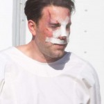 Ben Affleck plastic surgery (1)