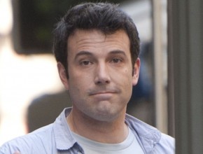 Ben Affleck plastic surgery (18)