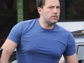 Ben Affleck plastic surgery (19)