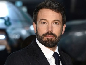 Ben Affleck plastic surgery (27)