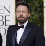 Ben Affleck plastic surgery (28)