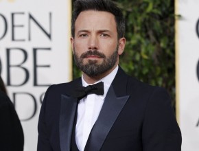 Ben Affleck plastic surgery (28)