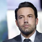 Ben Affleck plastic surgery (3)