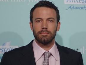 Ben Affleck plastic surgery (6)