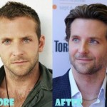 Bradley Cooper before and after plastic surgery (15)