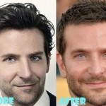 Bradley Cooper before and after plastic surgery (16)