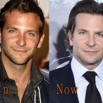 Bradley Cooper before and after plastic surgery (17)