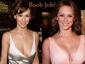 Jennifer Love Hewitt before and after breast implants (25)