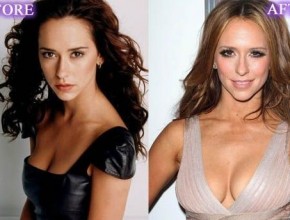 Jennifer Love Hewitt before and after breast implants