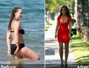 Jennifer Love Hewitt before and after plastic surgery (42)