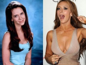 Jennifer Love Hewitt before and after plastic surgery (6)