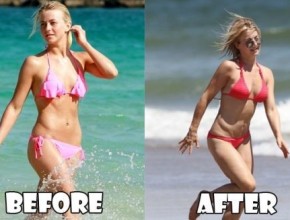 Julianne Hough before and after plastic surgery (19)