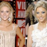 Julianne Hough before and after plastic surgery (26)