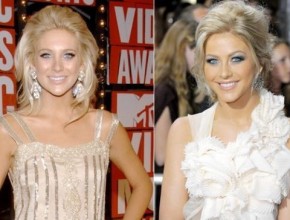 Julianne Hough before and after plastic surgery (26)