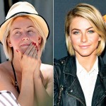 Julianne Hough before and after plastic surgery (3)