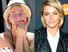 Julianne Hough before and after plastic surgery (3)