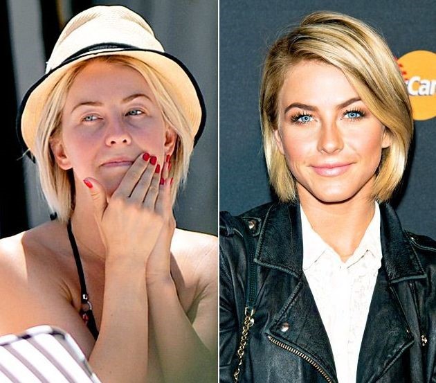 Julianne Hough before and after plastic surgery (3) .