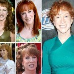 Kathy Griffin before and after plastic surgery (0)