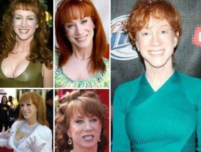 Kathy Griffin before and after plastic surgery (0)