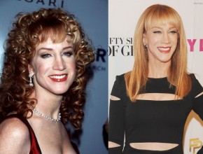 Kathy Griffin before and after plastic surgery (1)