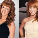 Kathy Griffin before and after plastic surgery (10)